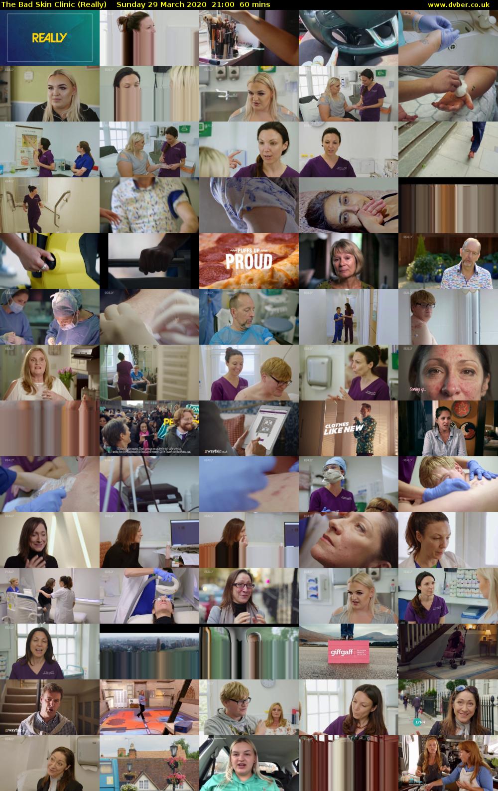 The Bad Skin Clinic (Really) Sunday 29 March 2020 21:00 - 22:00