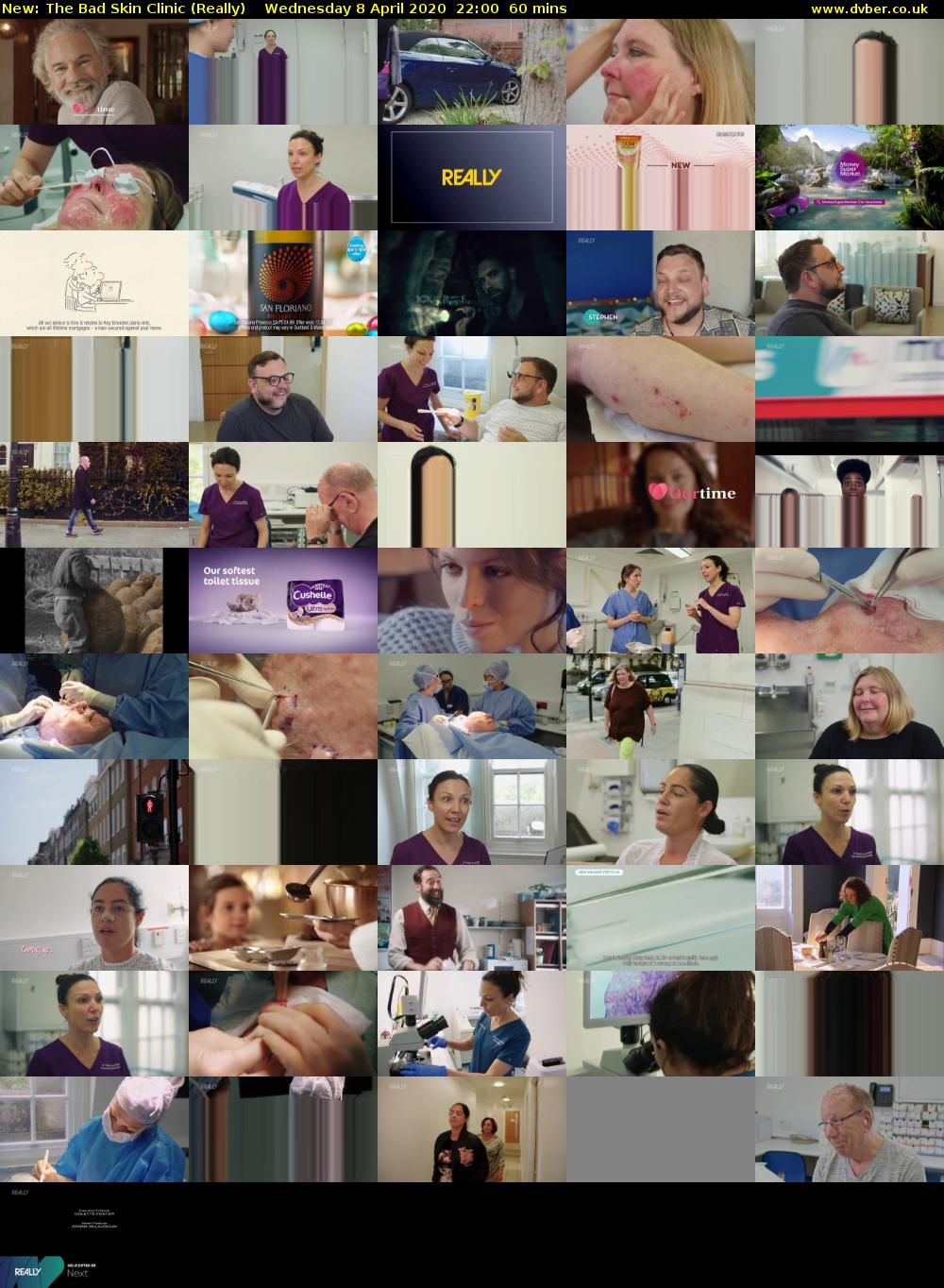The Bad Skin Clinic (Really) Wednesday 8 April 2020 22:00 - 23:00
