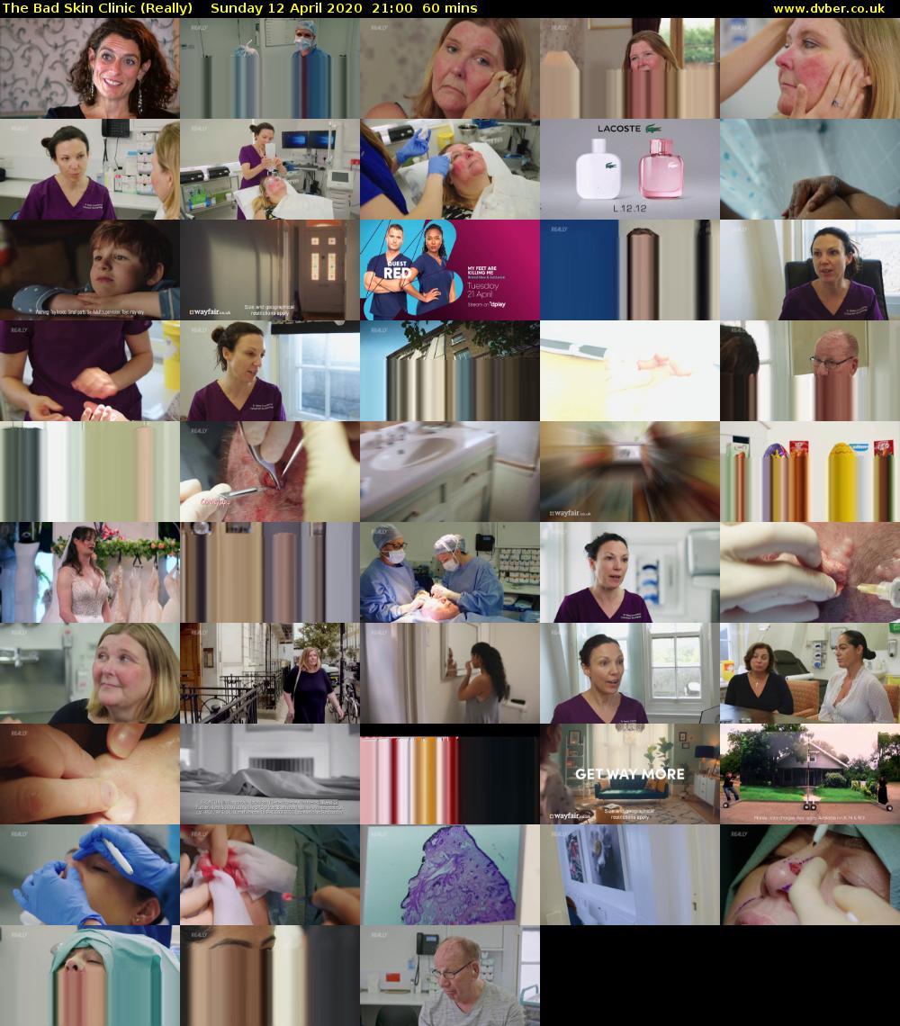 The Bad Skin Clinic (Really) Sunday 12 April 2020 21:00 - 22:00