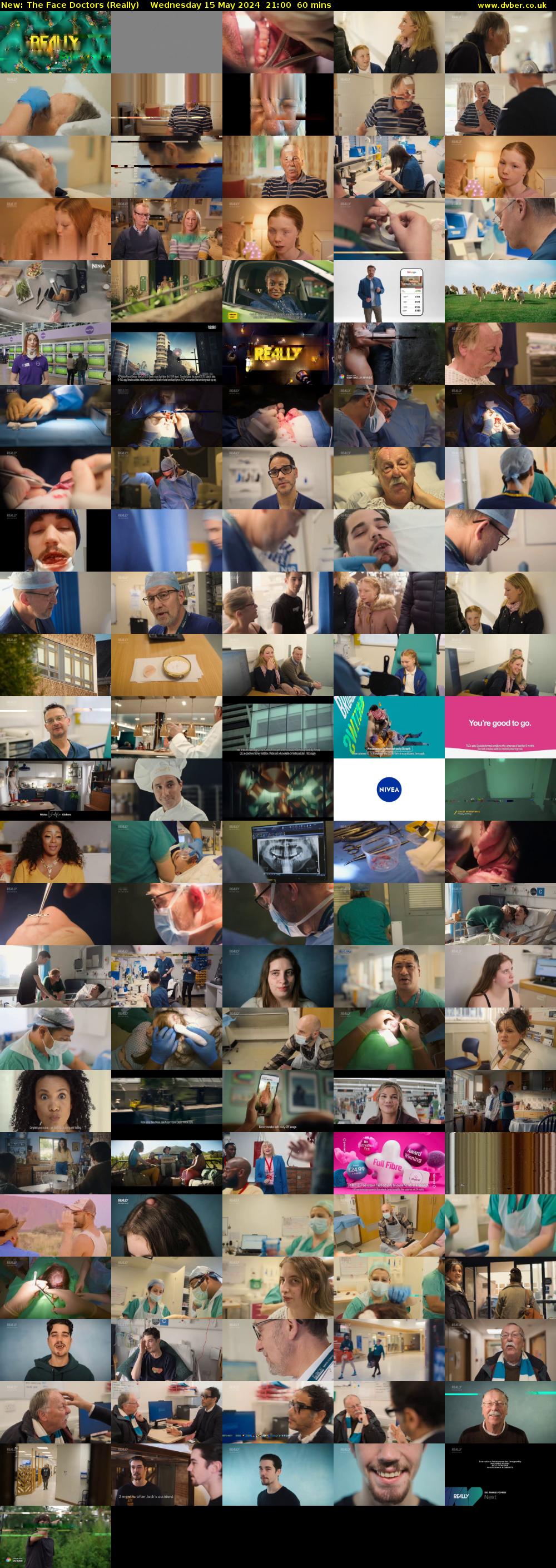 The Face Doctors (Really) Wednesday 15 May 2024 21:00 - 22:00