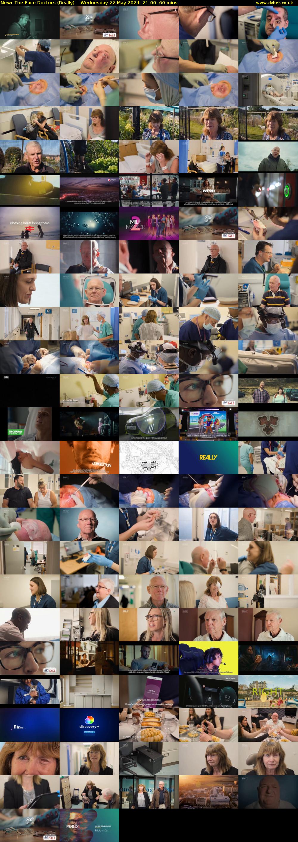 The Face Doctors (Really) Wednesday 22 May 2024 21:00 - 22:00