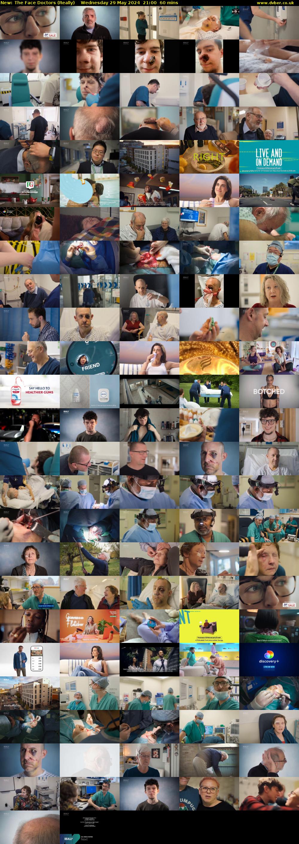 The Face Doctors (Really) Wednesday 29 May 2024 21:00 - 22:00