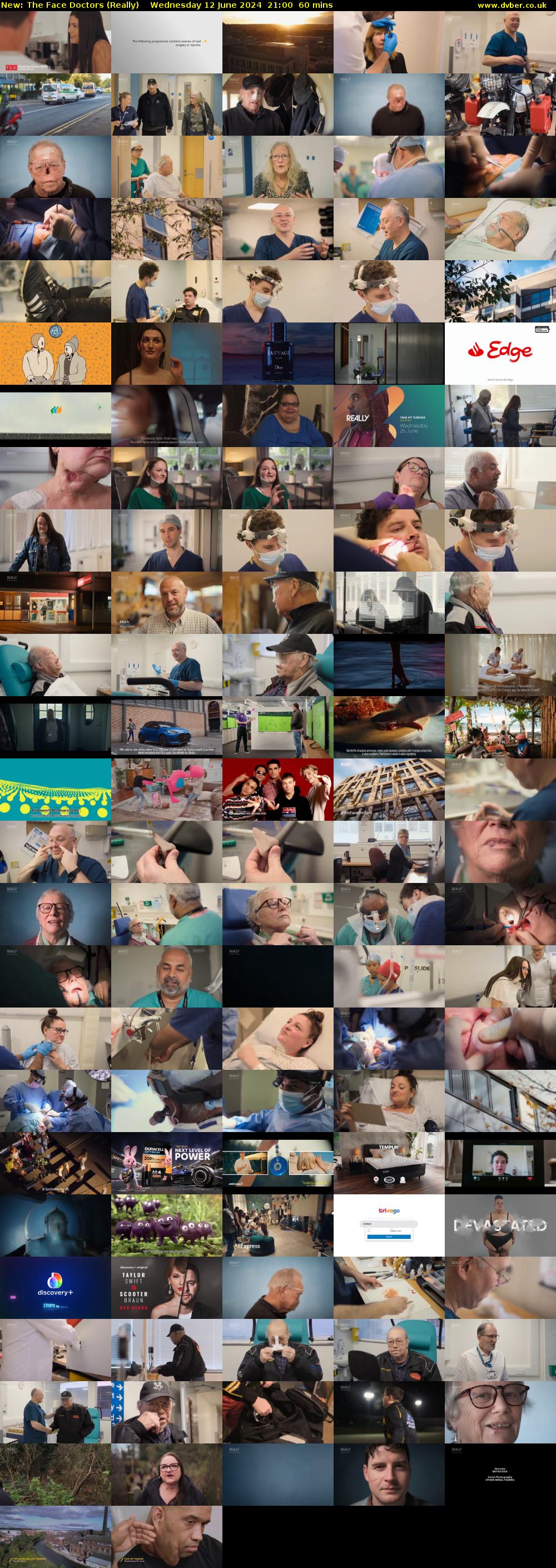 The Face Doctors (Really) Wednesday 12 June 2024 21:00 - 22:00