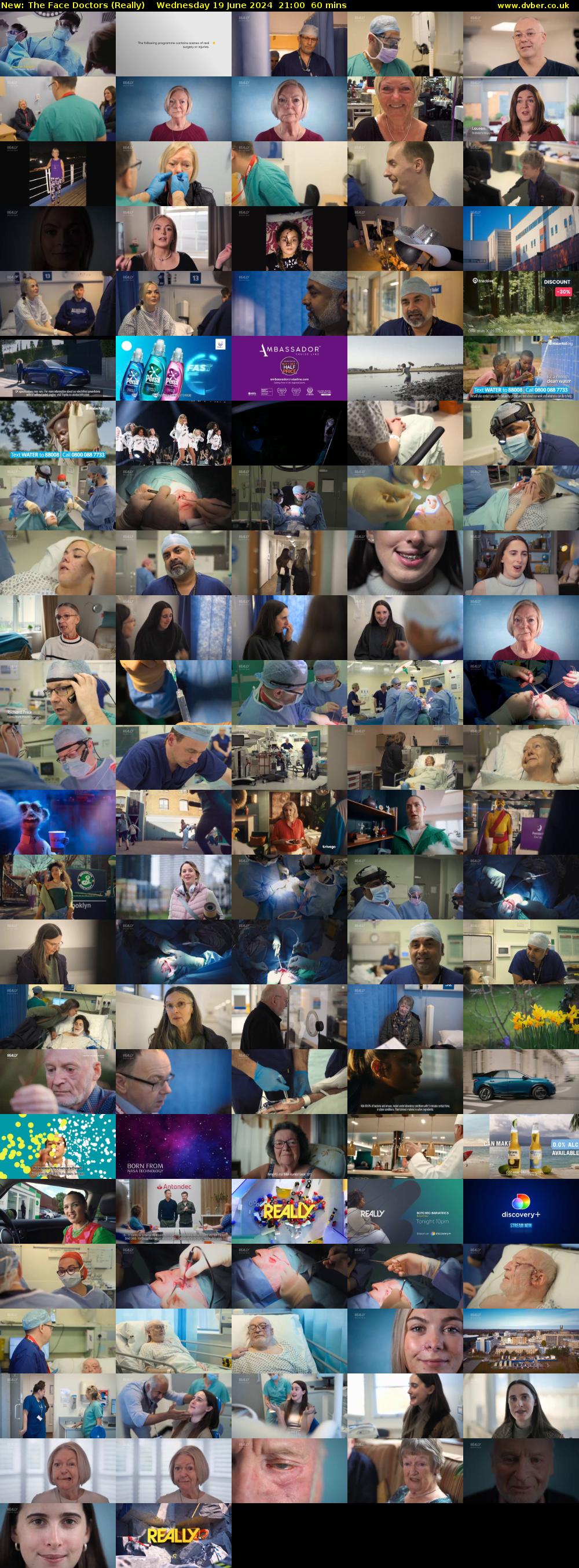 The Face Doctors (Really) Wednesday 19 June 2024 21:00 - 22:00