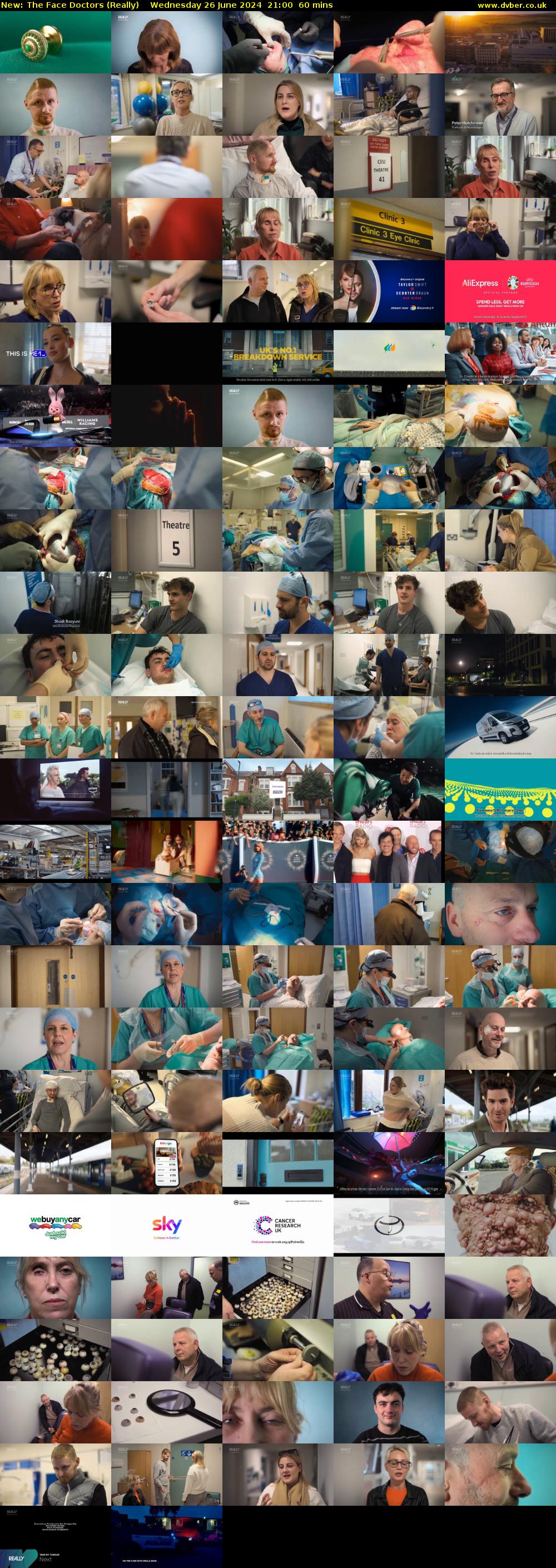 The Face Doctors (Really) Wednesday 26 June 2024 21:00 - 22:00
