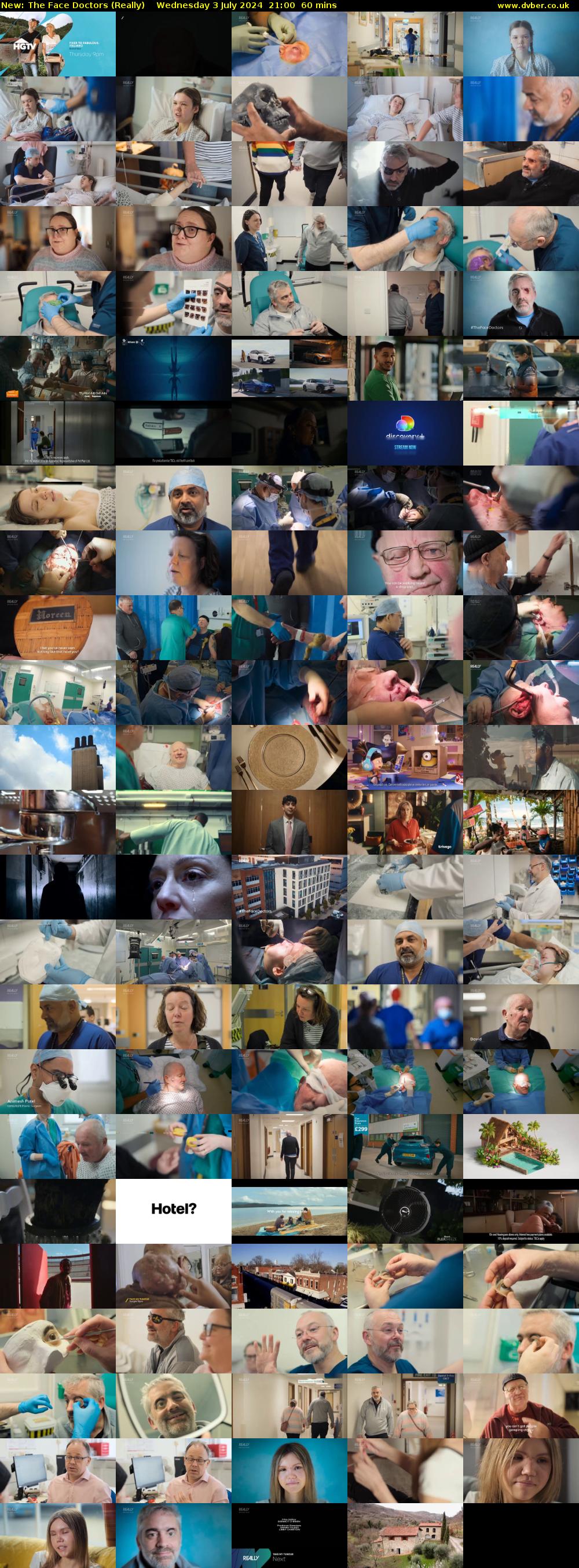 The Face Doctors (Really) Wednesday 3 July 2024 21:00 - 22:00