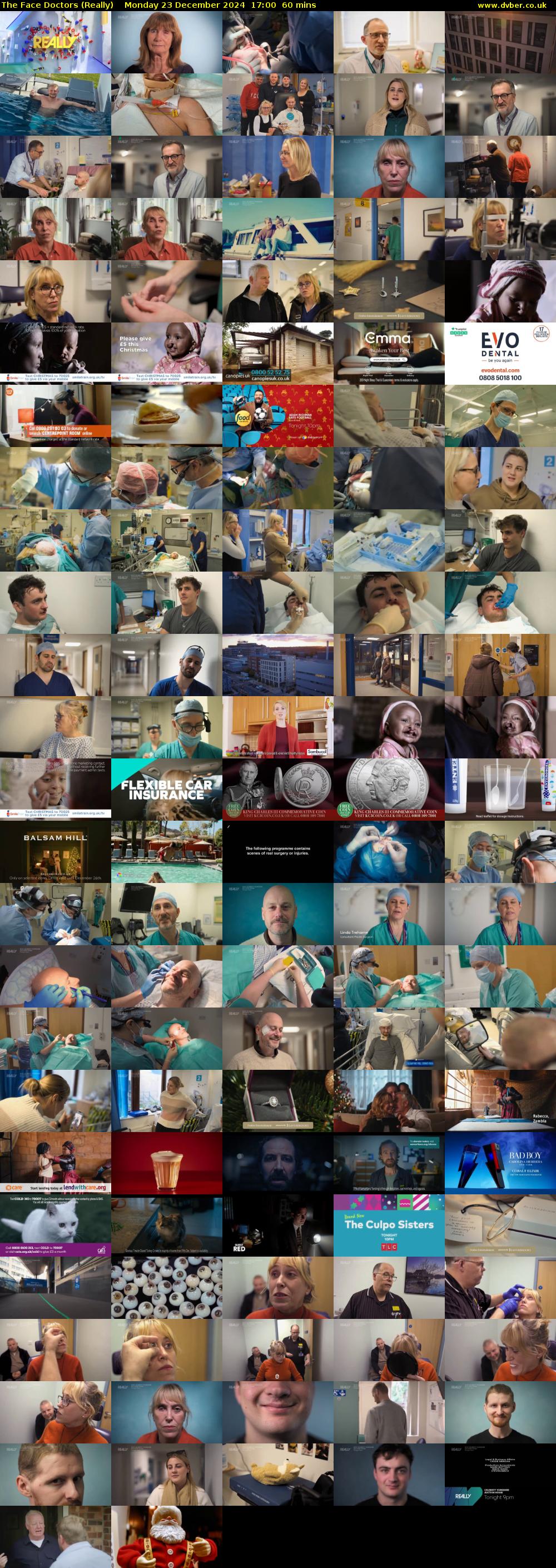The Face Doctors (Really) Monday 23 December 2024 17:00 - 18:00