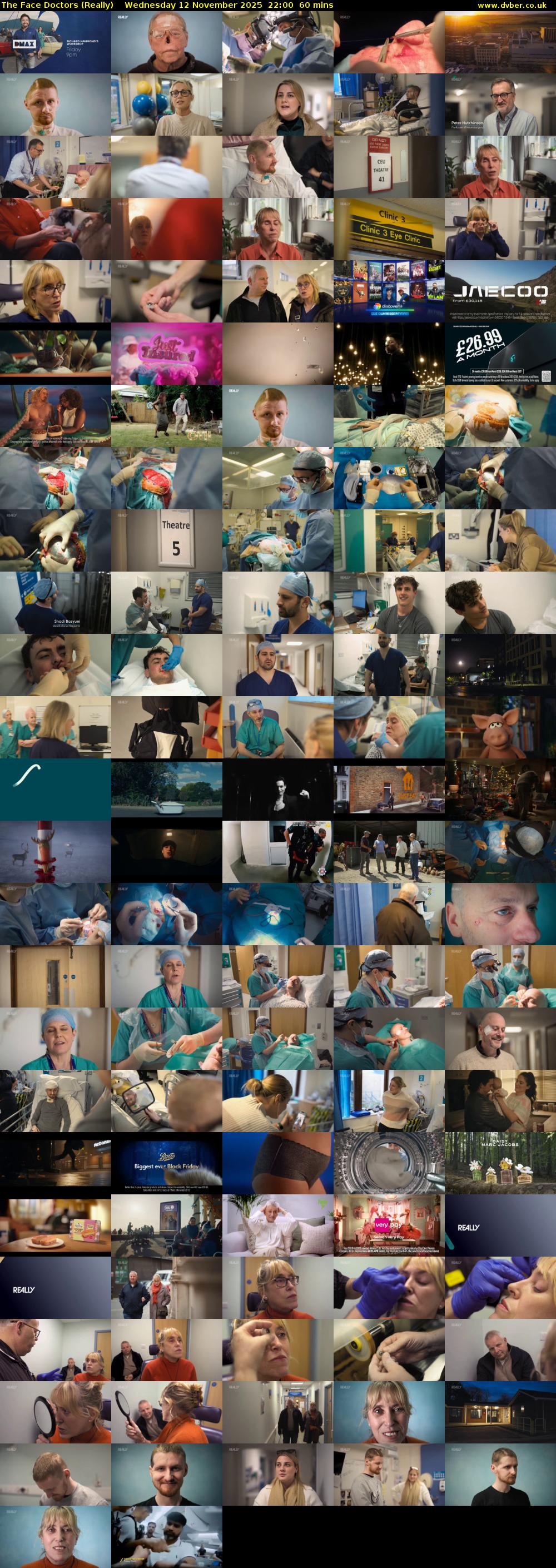 The Face Doctors (Really) Wednesday 12 November 2025 22:00 - 23:00