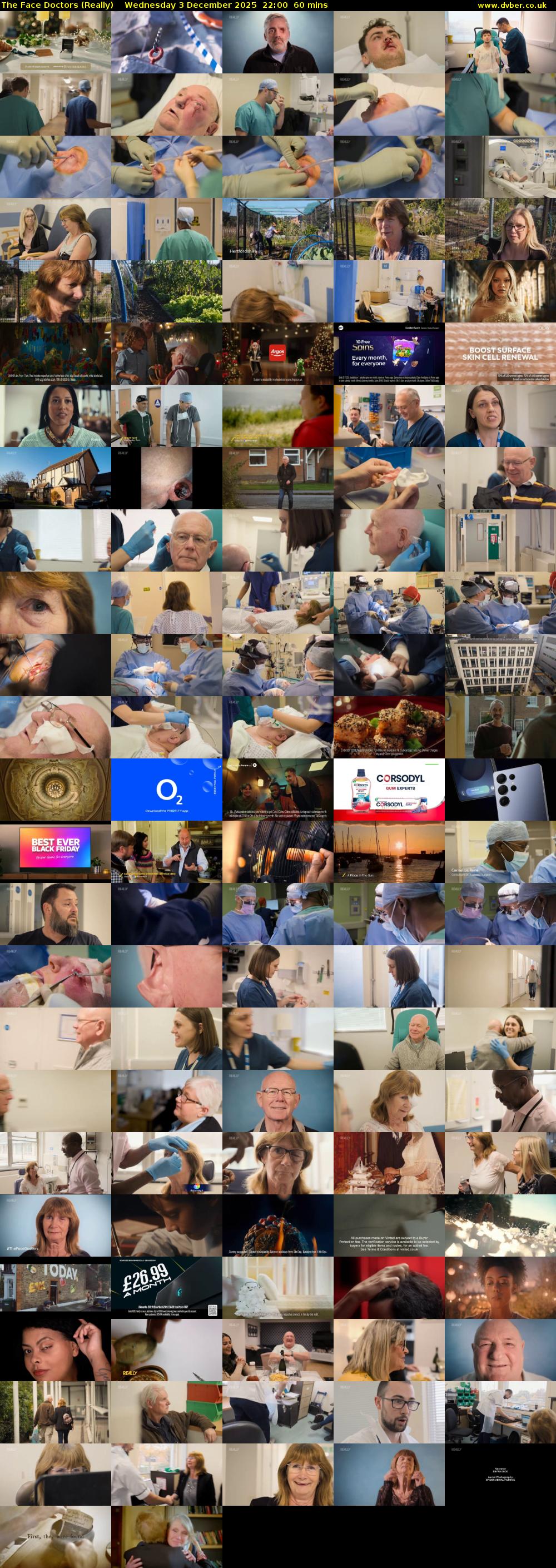 The Face Doctors (Really) Wednesday 3 December 2025 22:00 - 23:00