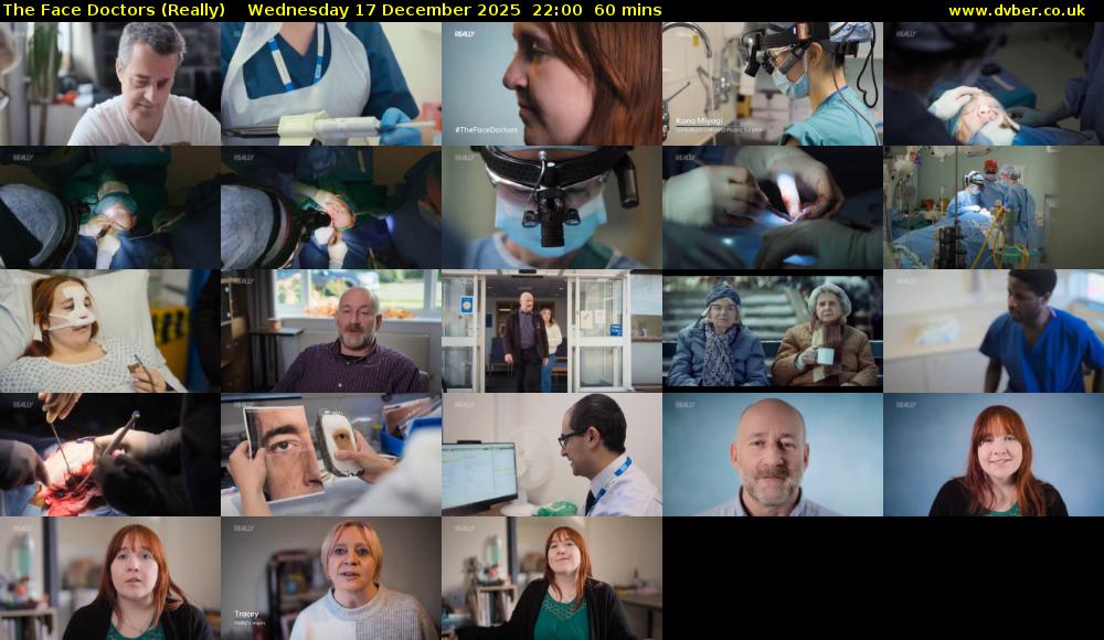 The Face Doctors (Really) Wednesday 17 December 2025 22:00 - 23:00