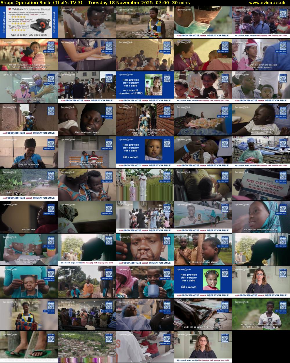 Shop: Operation Smile (That's TV 3) Tuesday 18 November 2025 07:00 - 07:30