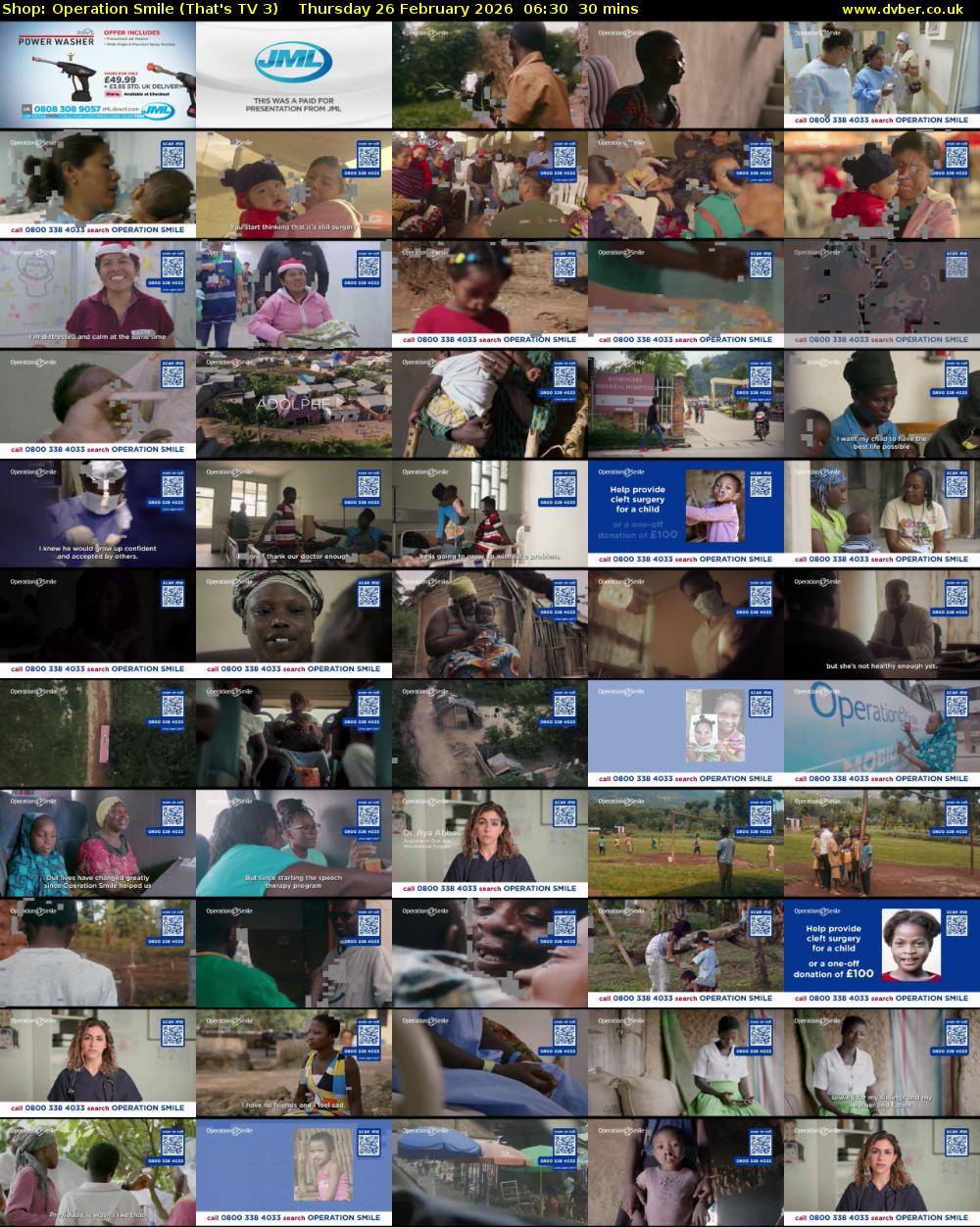 Shop: Operation Smile (That's TV 3) Thursday 26 February 2026 06:30 - 07:00