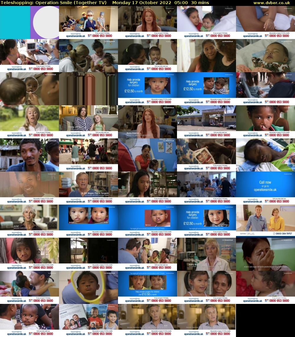 Teleshopping: Operation Smile (Together TV) Monday 17 October 2022 05:00 - 05:30