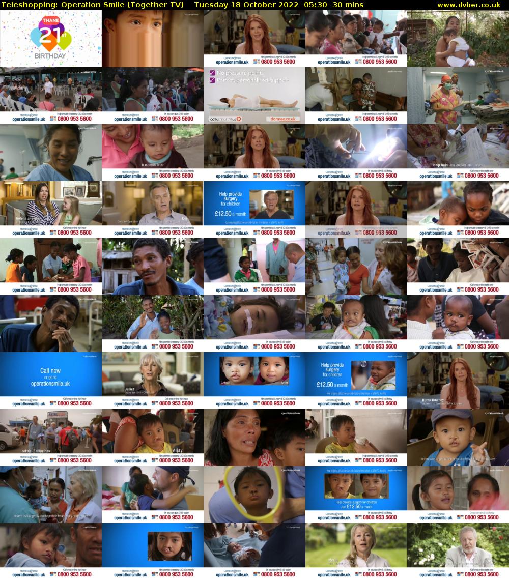 Teleshopping: Operation Smile (Together TV) Tuesday 18 October 2022 05:30 - 06:00