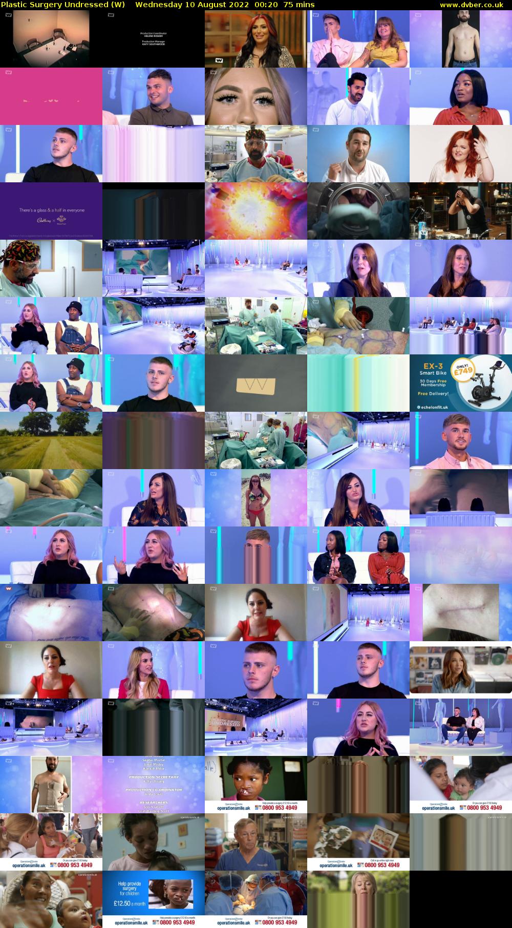 Plastic Surgery Undressed (W) Wednesday 10 August 2022 00:20 - 01:35