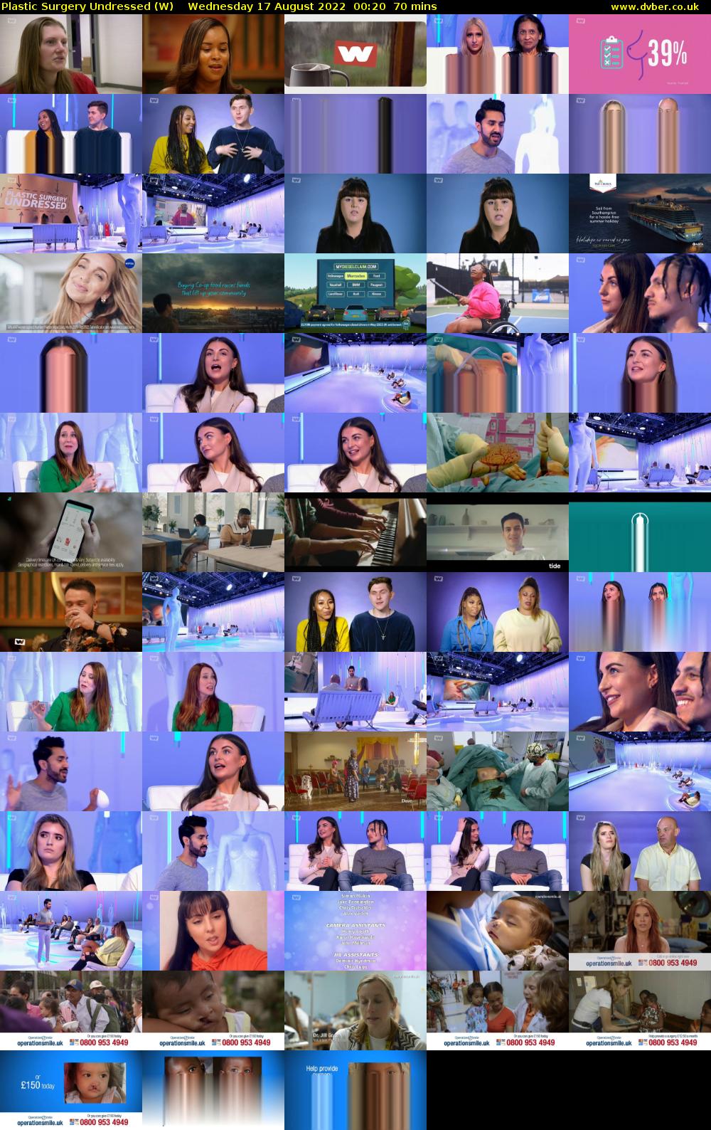 Plastic Surgery Undressed (W) Wednesday 17 August 2022 00:20 - 01:30