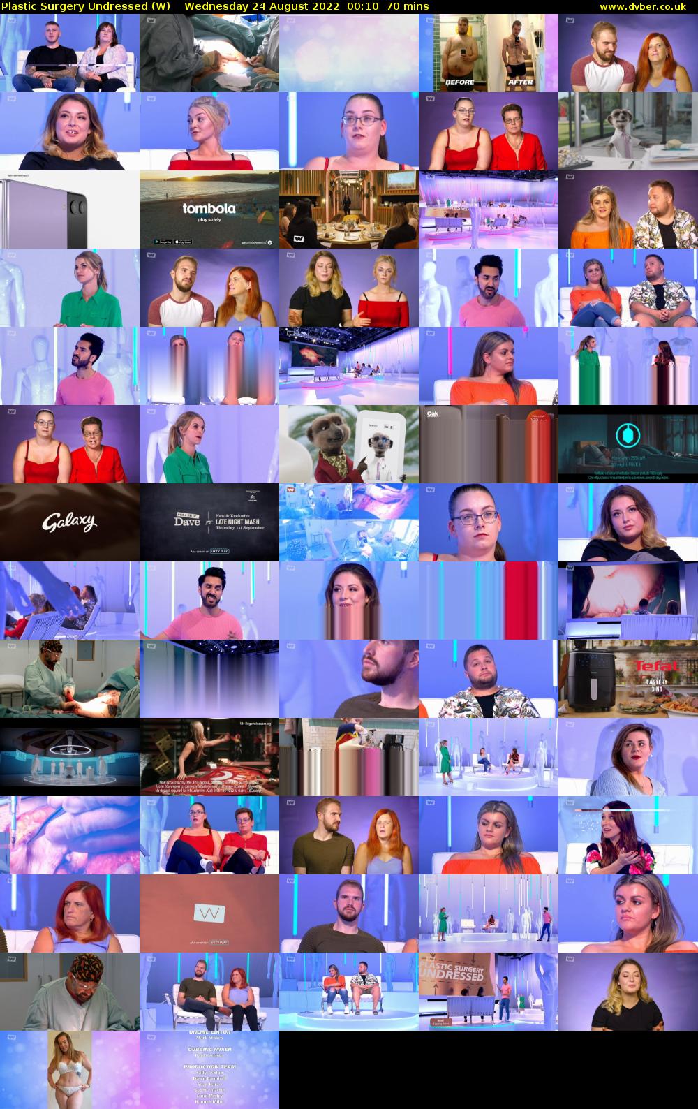 Plastic Surgery Undressed (W) Wednesday 24 August 2022 00:10 - 01:20