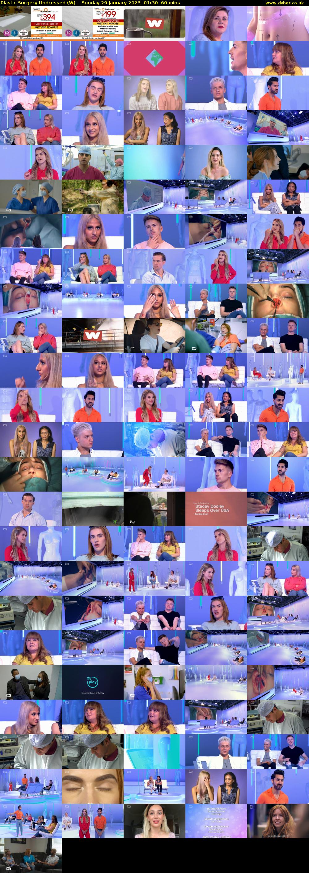 Plastic Surgery Undressed (W) Sunday 29 January 2023 01:30 - 02:30