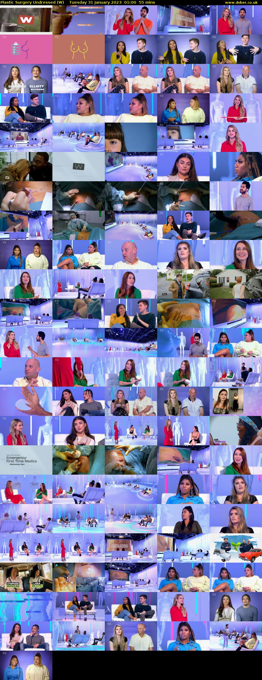 Plastic Surgery Undressed (W) Tuesday 31 January 2023 01:00 - 01:55