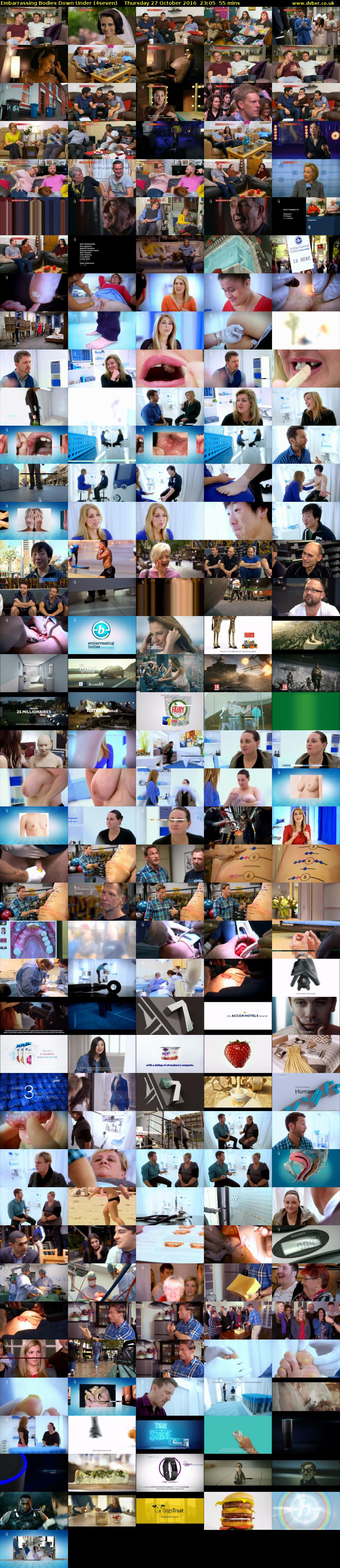 Embarrassing Bodies Down Under (4seven) Thursday 27 October 2016 23:05 - 00:00