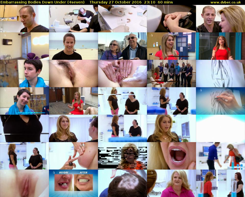 Embarrassing Bodies Down Under (4seven) Thursday 27 October 2016 23:10 - 00:10
