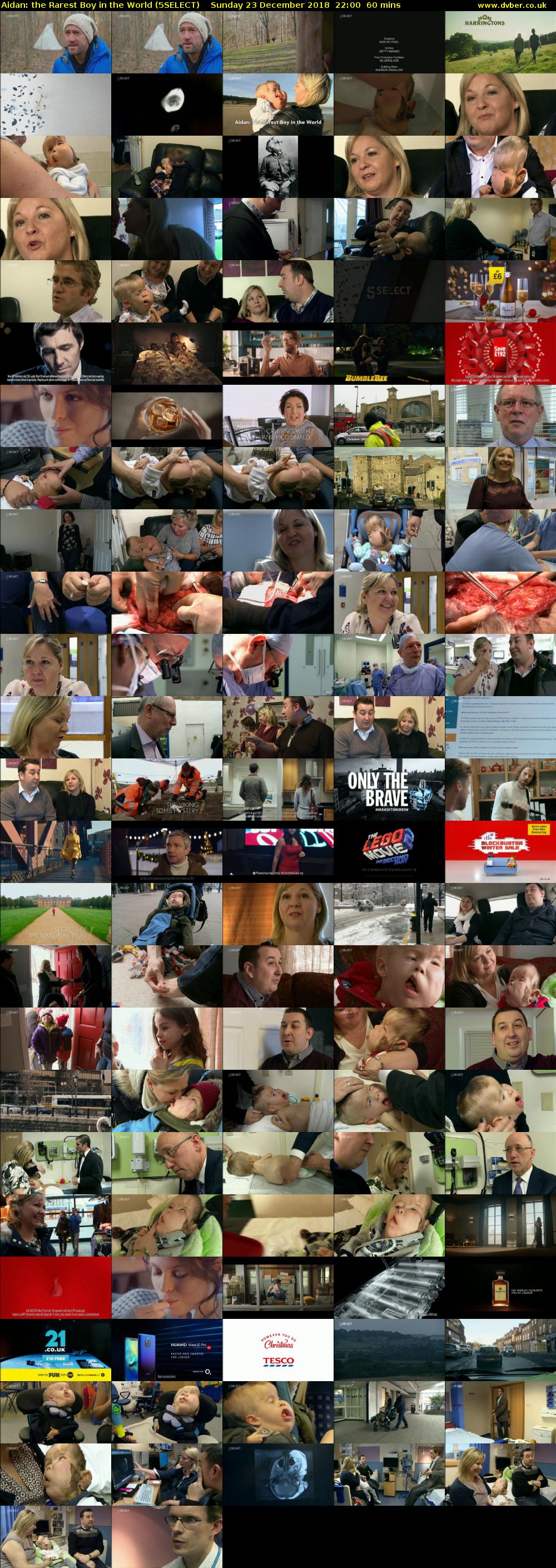 Aidan: the Rarest Boy in the World (5SELECT) Sunday 23 December 2018 22:00 - 23:00