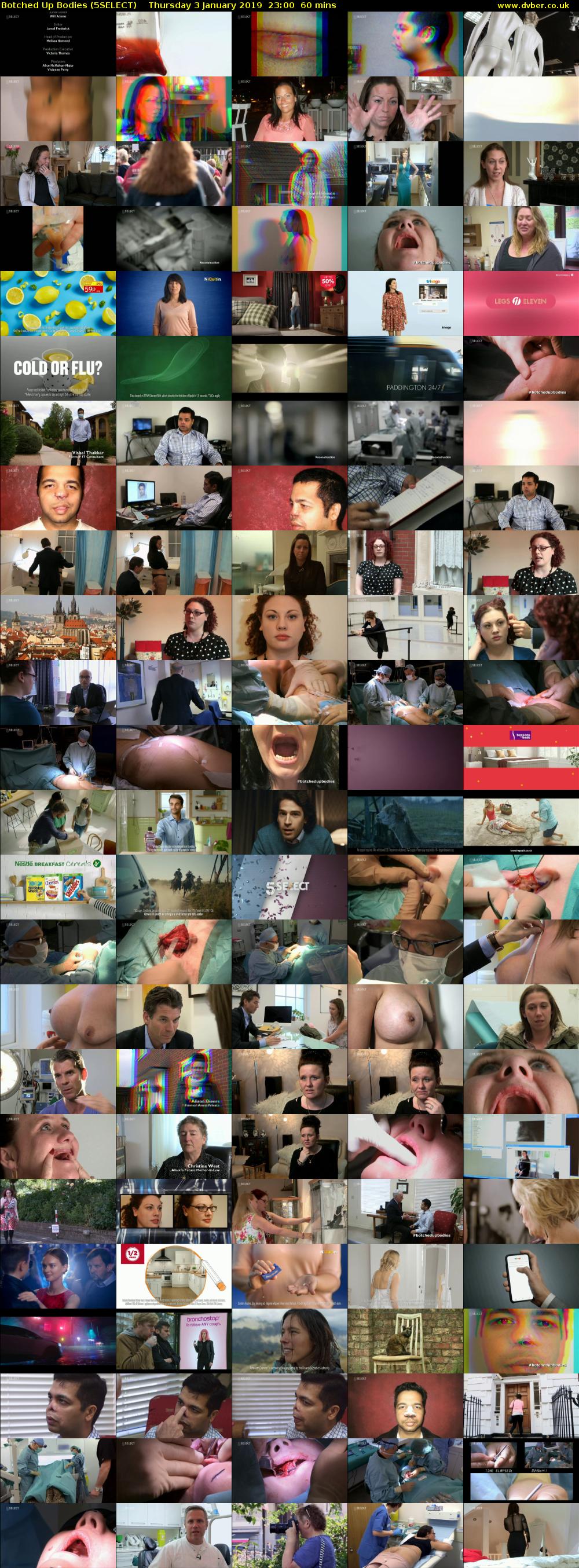 Botched Up Bodies (5SELECT) Thursday 3 January 2019 23:00 - 00:00