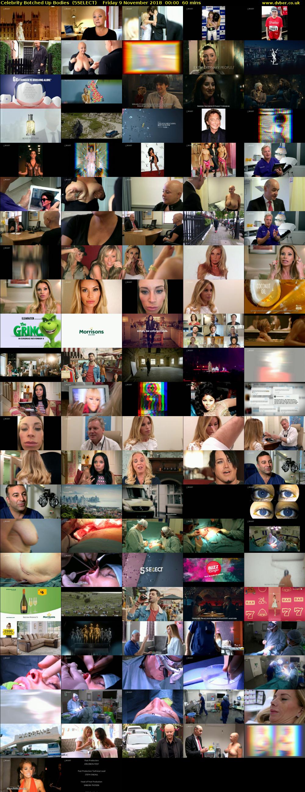 Celebrity Botched Up Bodies  (5SELECT) Friday 9 November 2018 00:00 - 01:00