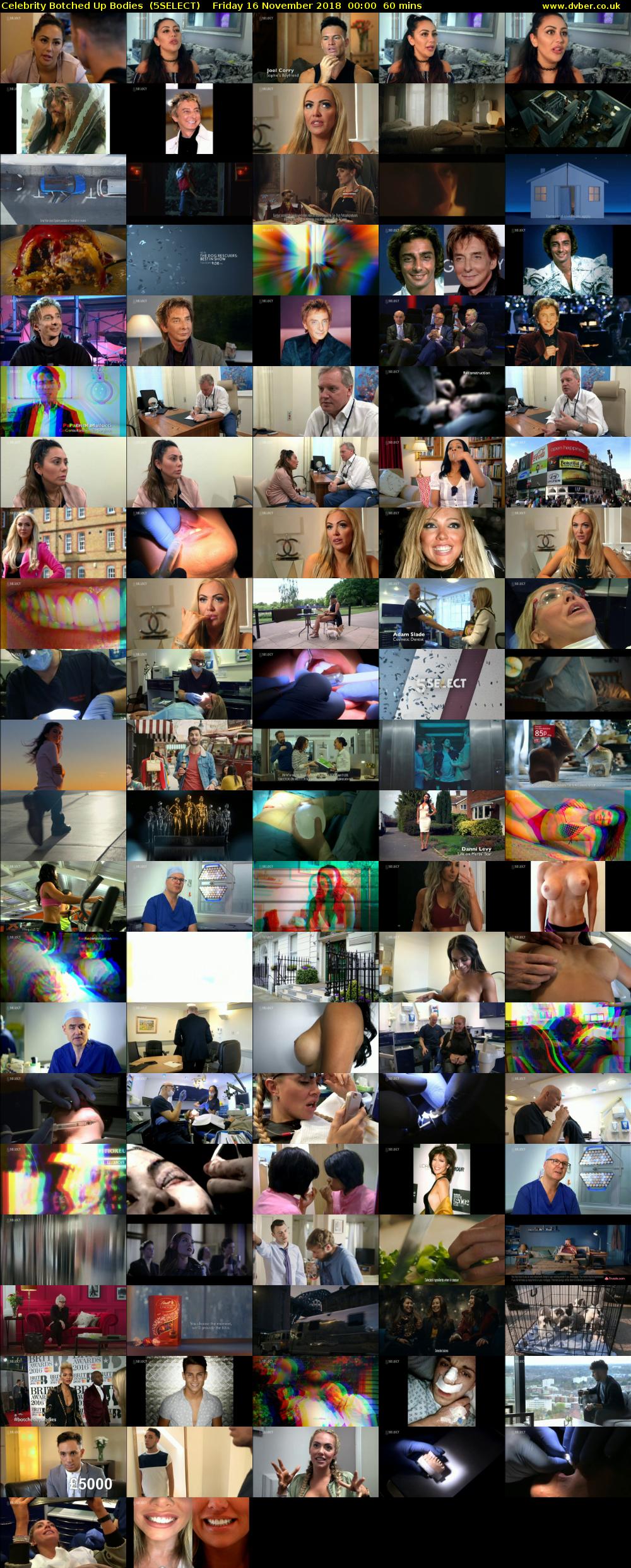 Celebrity Botched Up Bodies  (5SELECT) Friday 16 November 2018 00:00 - 01:00