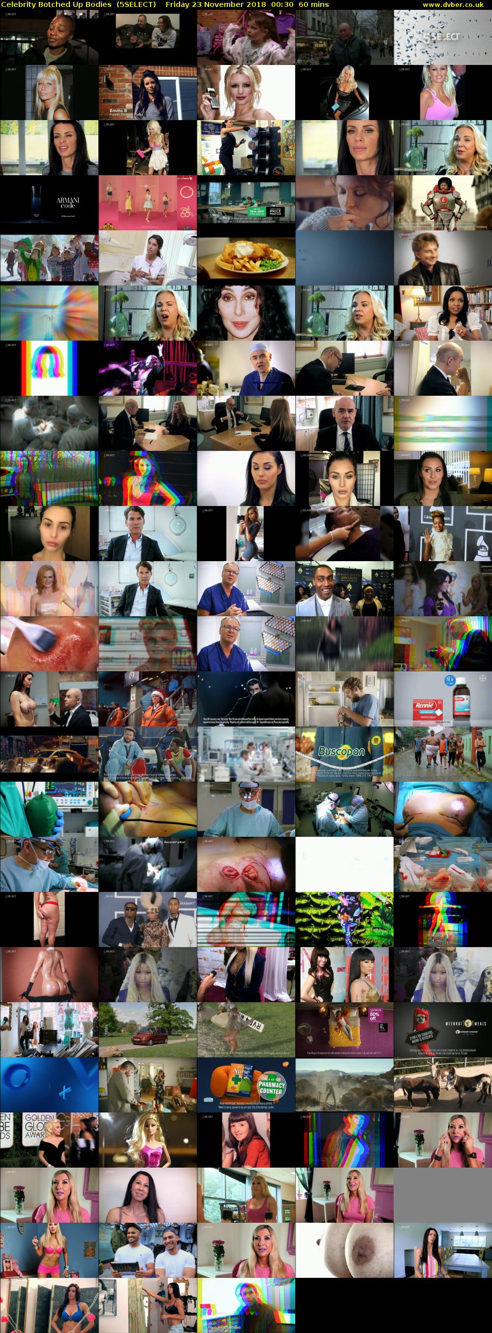 Celebrity Botched Up Bodies  (5SELECT) Friday 23 November 2018 00:30 - 01:30