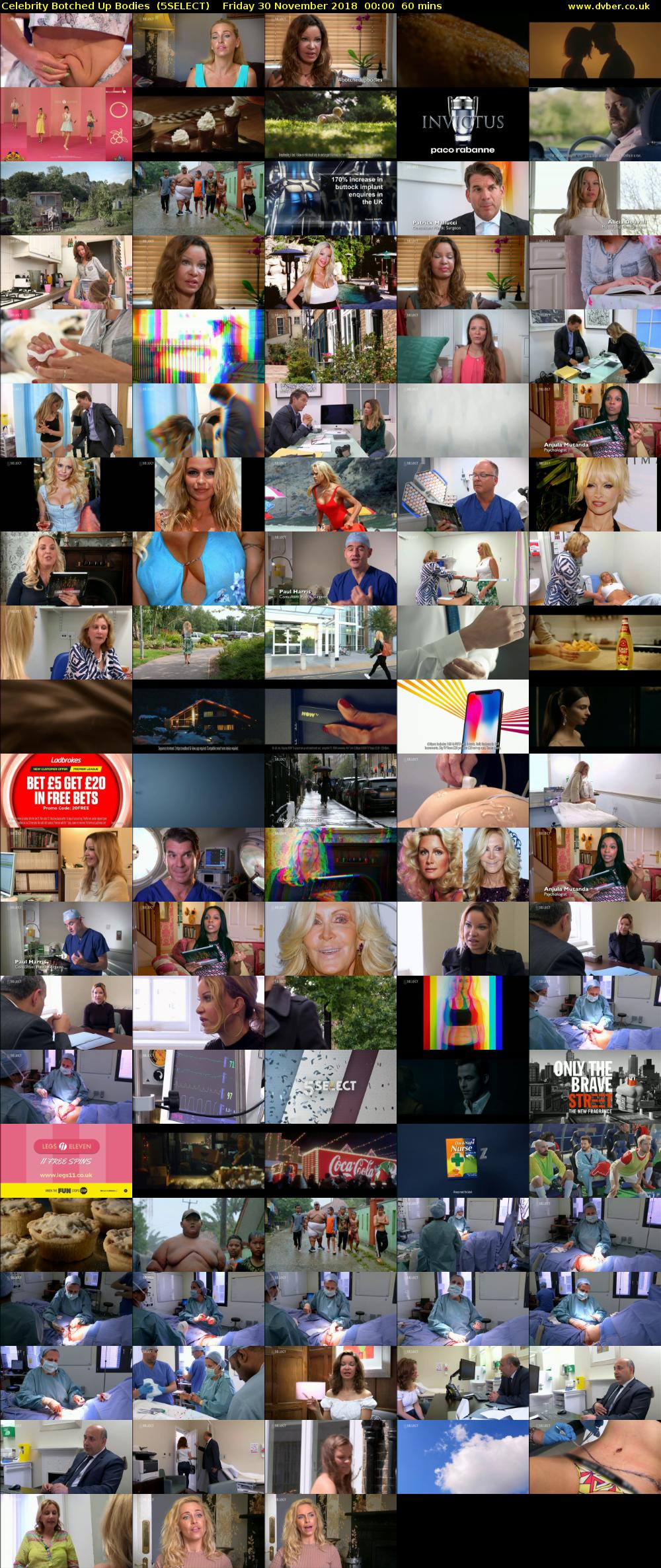 Celebrity Botched Up Bodies  (5SELECT) Friday 30 November 2018 00:00 - 01:00