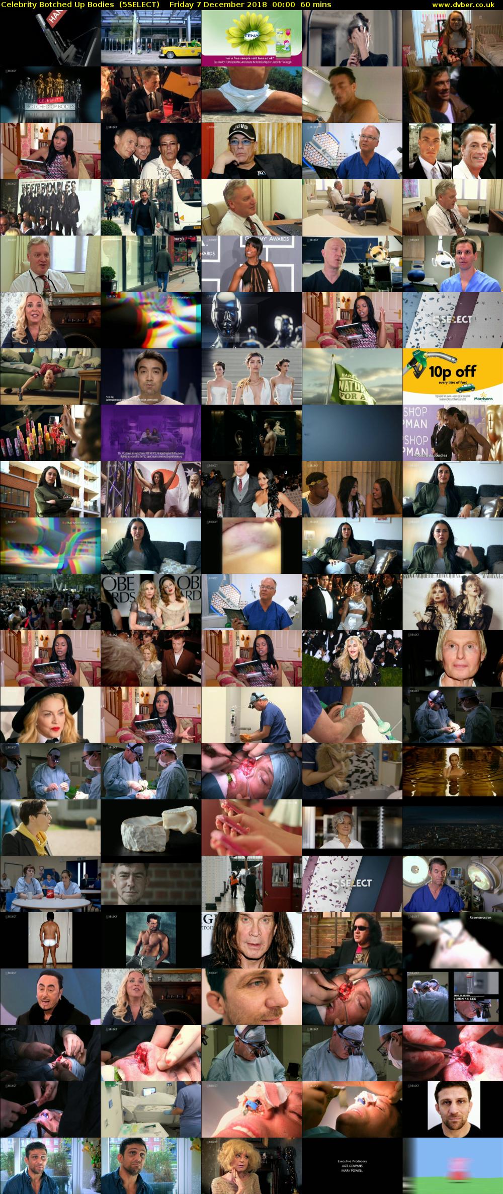 Celebrity Botched Up Bodies  (5SELECT) Friday 7 December 2018 00:00 - 01:00