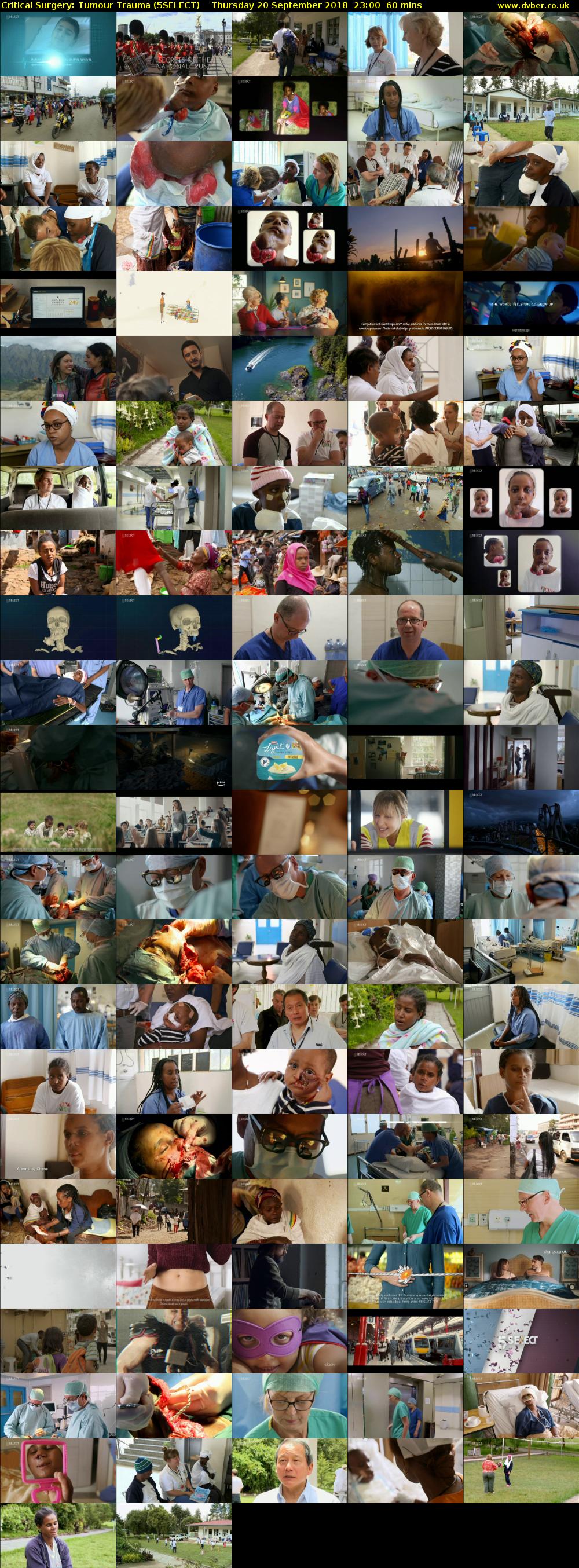 Critical Surgery: Tumour Trauma (5SELECT) Thursday 20 September 2018 23:00 - 00:00