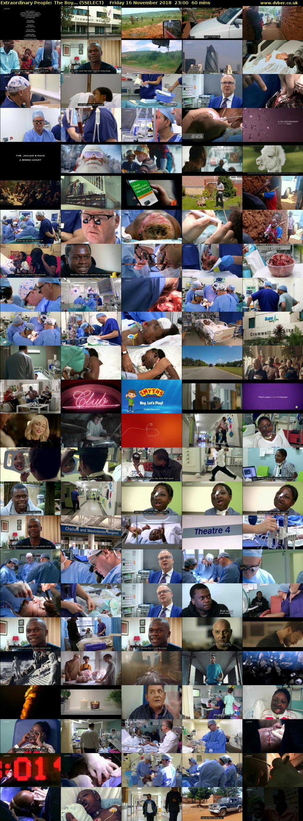 Extraordinary People: The Boy... (5SELECT) Friday 16 November 2018 23:00 - 00:00