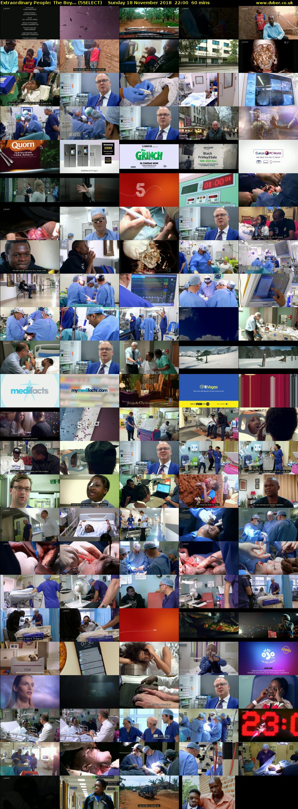 Extraordinary People: The Boy... (5SELECT) Sunday 18 November 2018 22:00 - 23:00