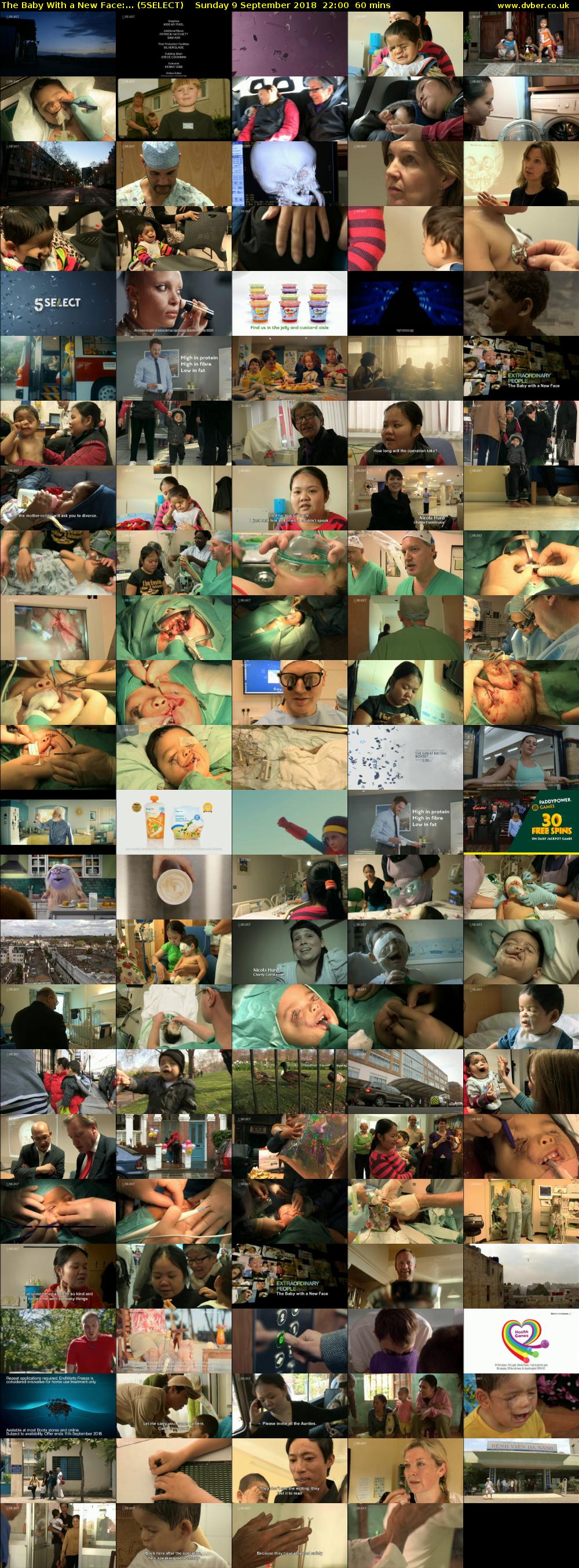 The Baby With a New Face:... (5SELECT) Sunday 9 September 2018 22:00 - 23:00