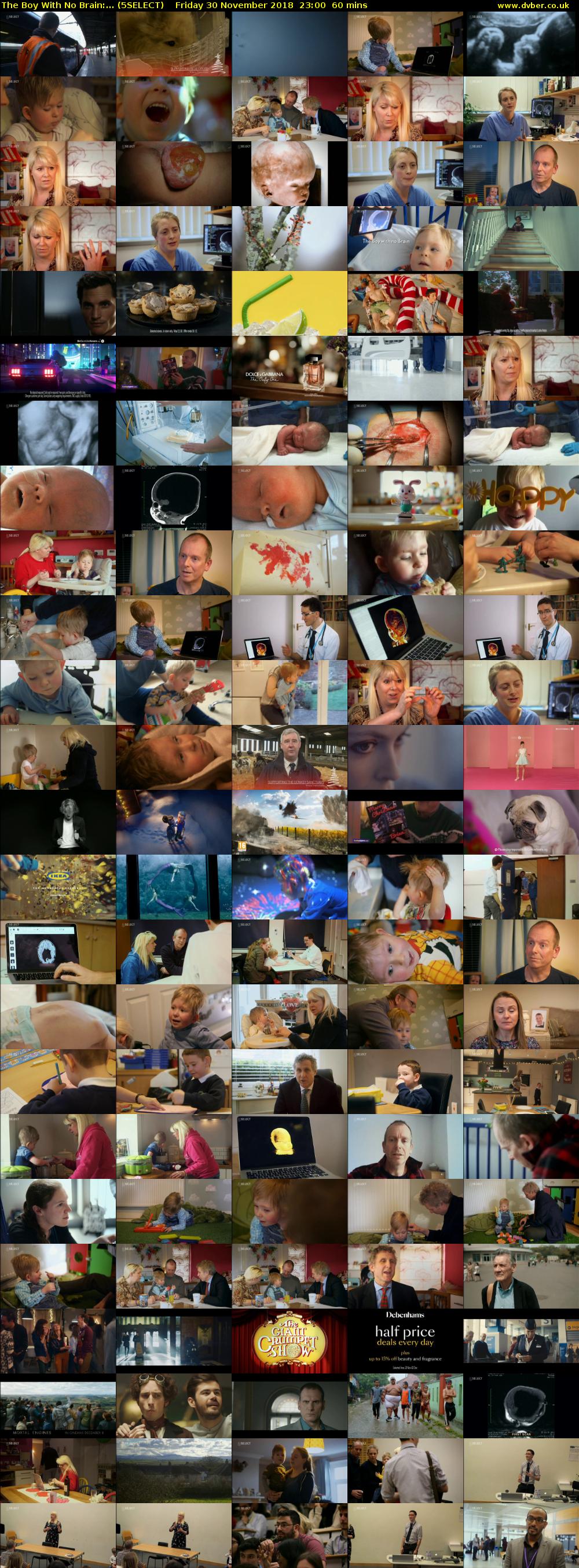 The Boy With No Brain:... (5SELECT) Friday 30 November 2018 23:00 - 00:00