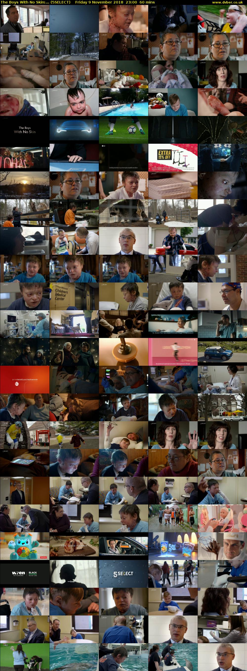 The Boys With No Skin:... (5SELECT) Friday 9 November 2018 23:00 - 00:00