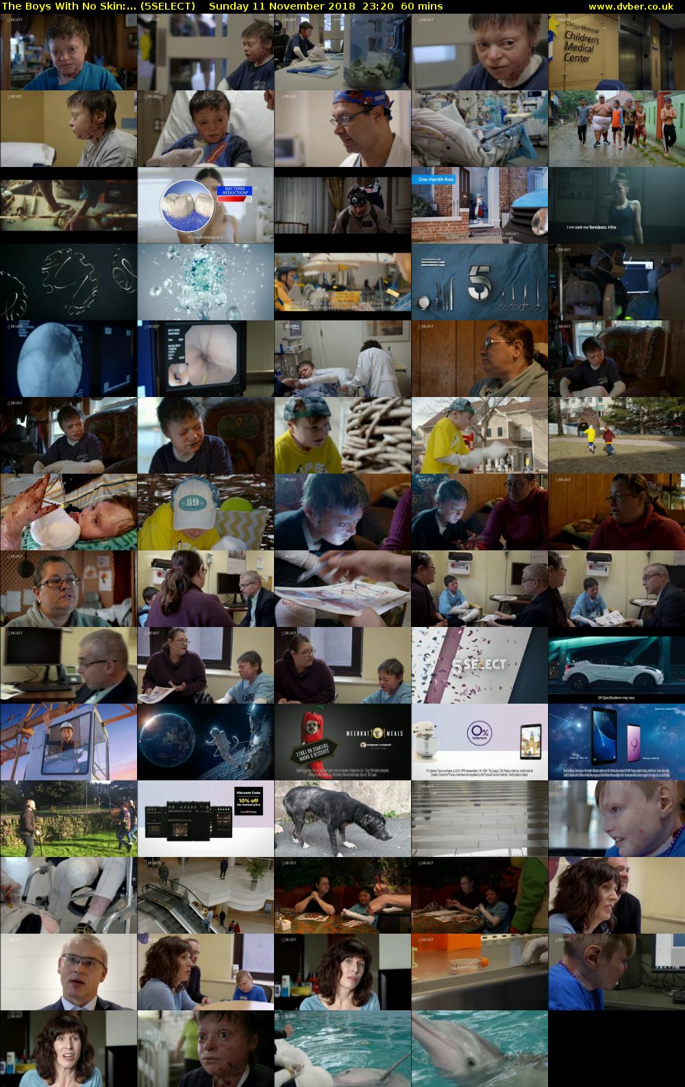 The Boys With No Skin:... (5SELECT) Sunday 11 November 2018 23:20 - 00:20
