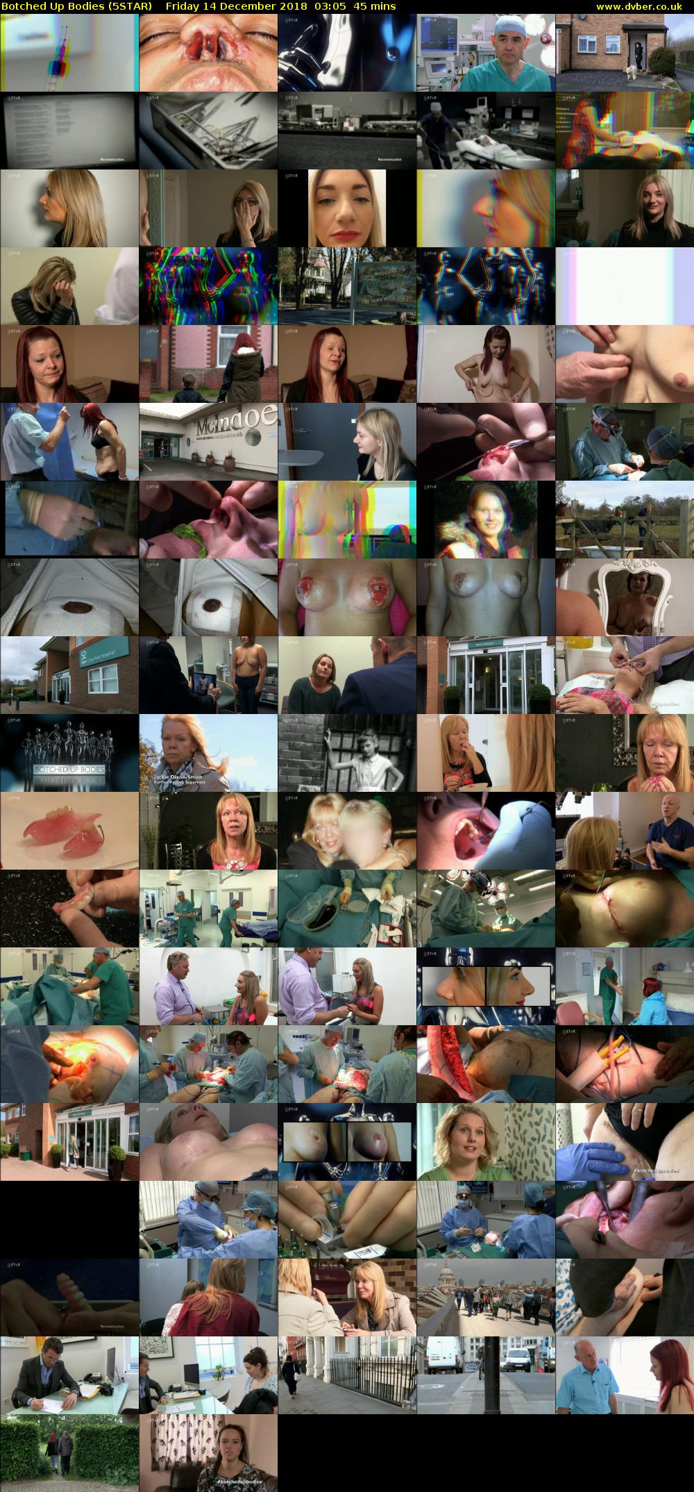 Botched Up Bodies (5STAR) Friday 14 December 2018 03:05 - 03:50