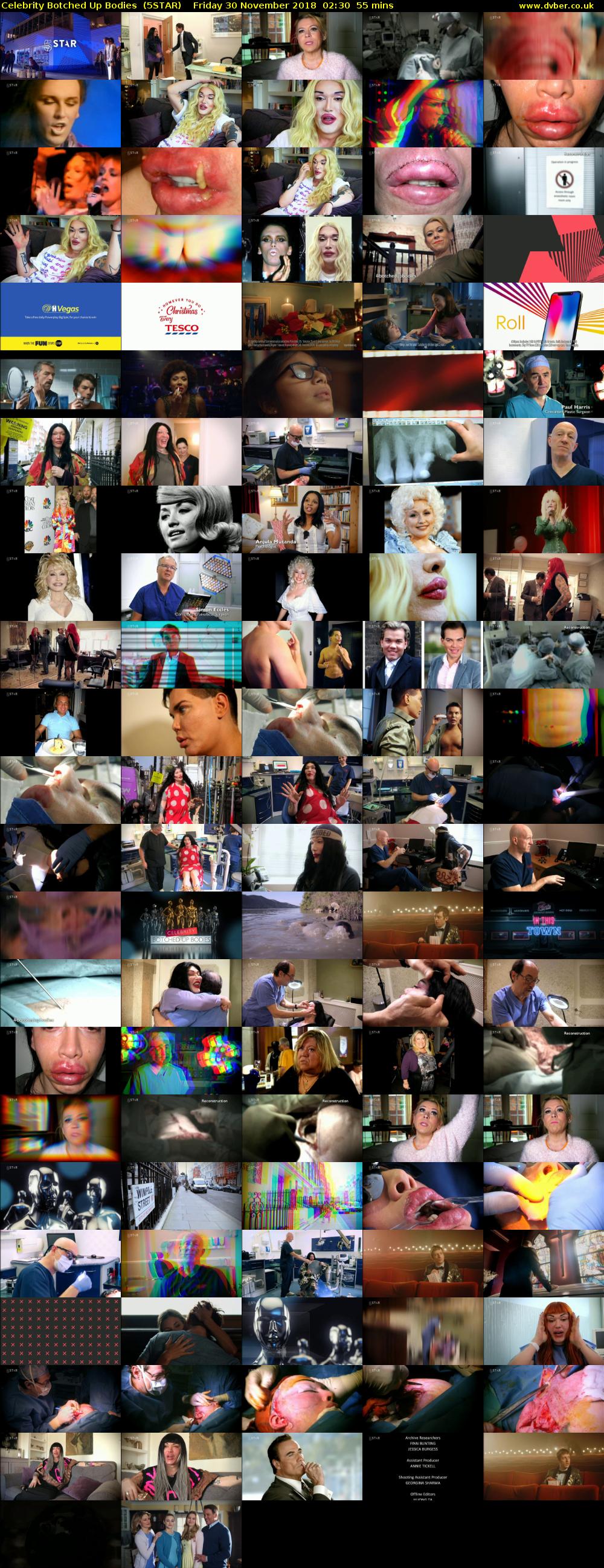 Celebrity Botched Up Bodies  (5STAR) Friday 30 November 2018 02:30 - 03:25