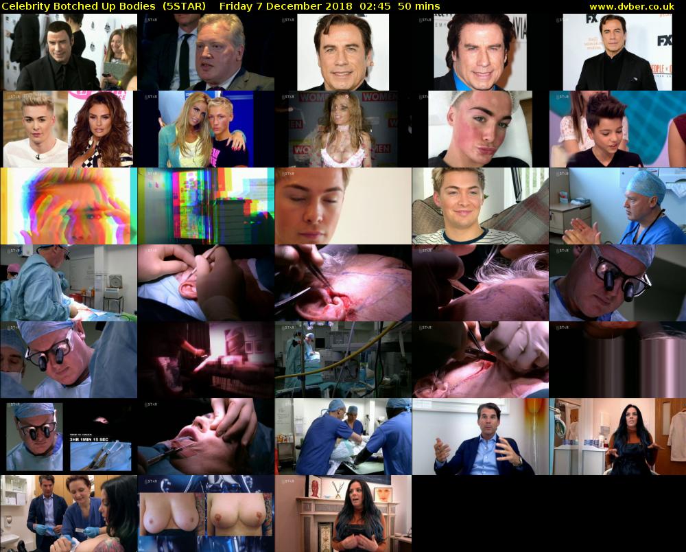 Celebrity Botched Up Bodies  (5STAR) Friday 7 December 2018 02:45 - 03:35