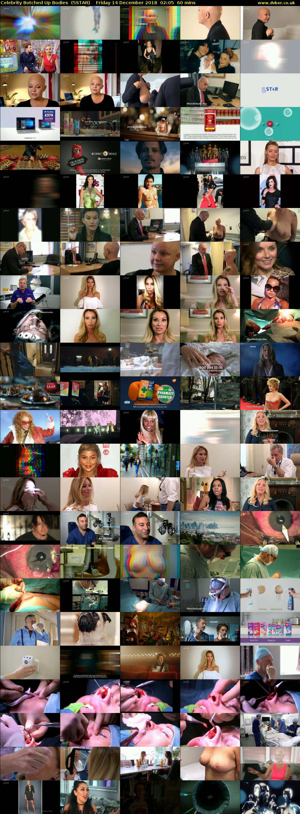 Celebrity Botched Up Bodies  (5STAR) Friday 14 December 2018 02:05 - 03:05