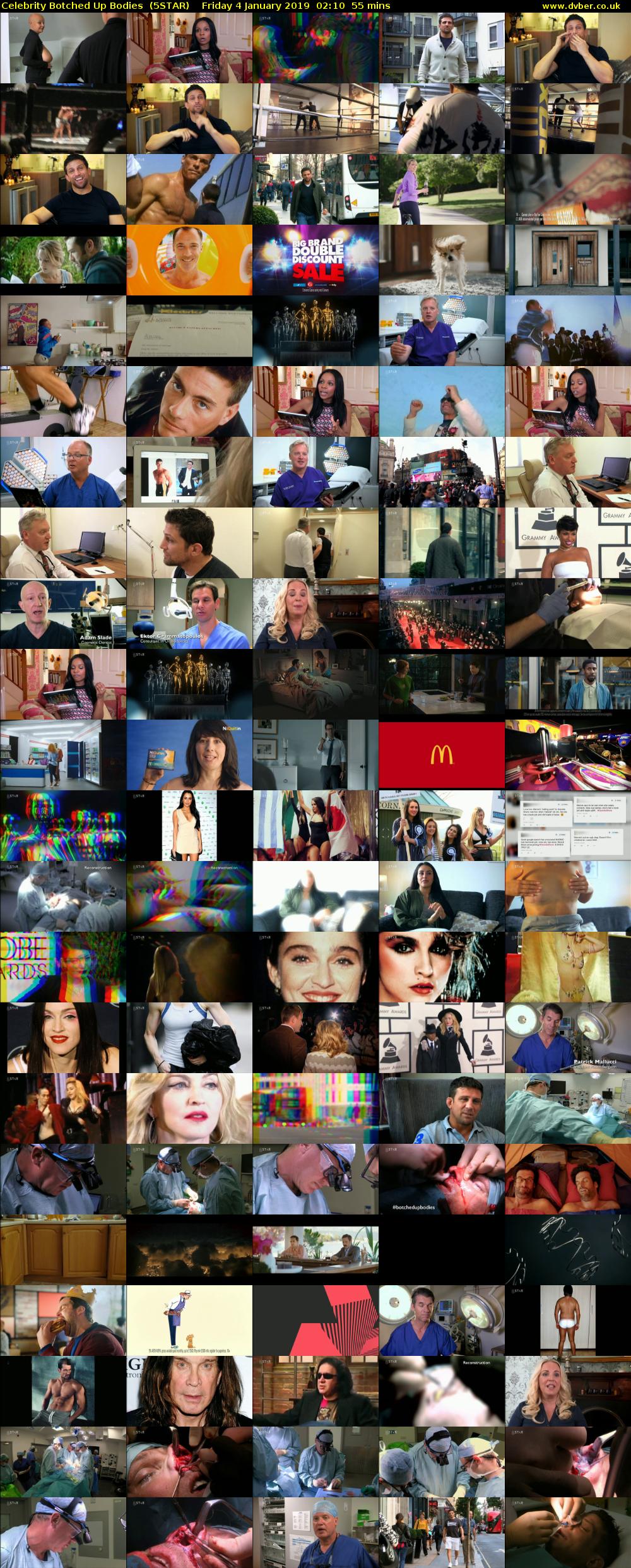 Celebrity Botched Up Bodies  (5STAR) Friday 4 January 2019 02:10 - 03:05