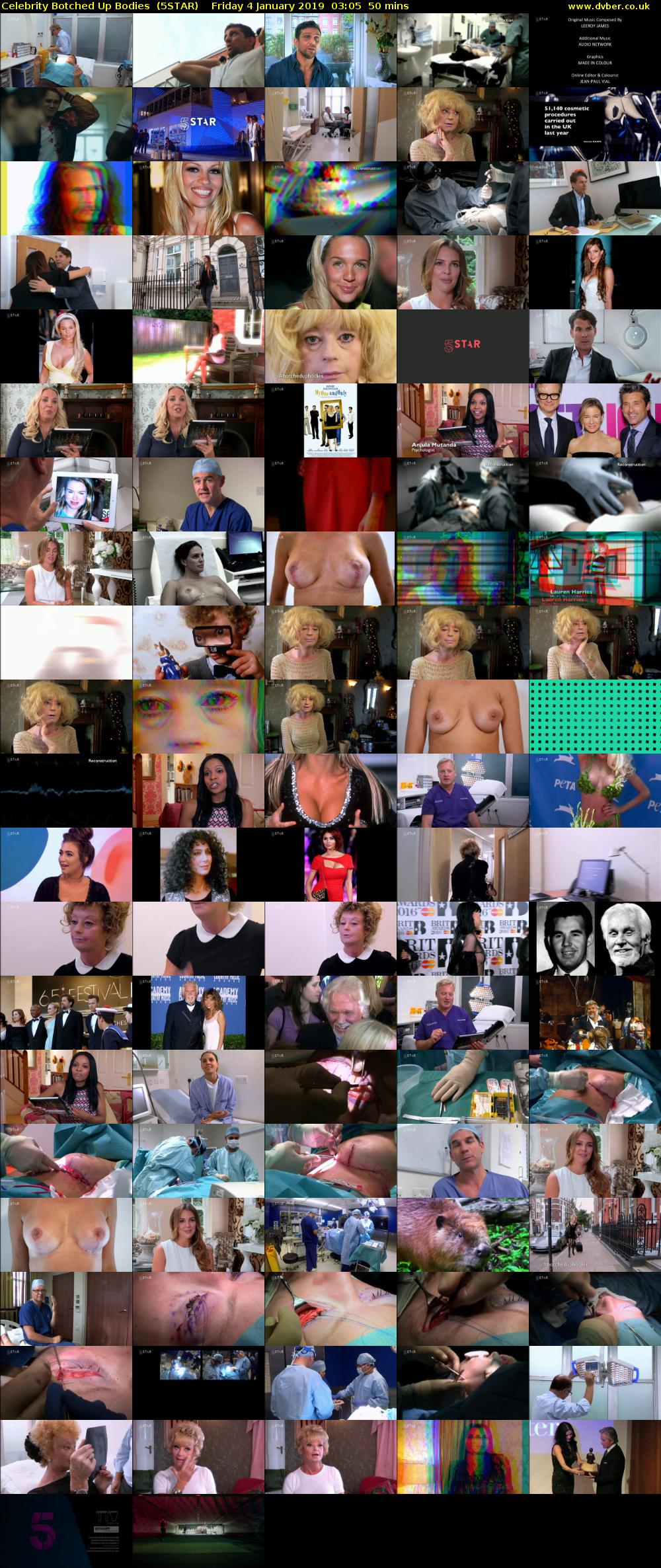 Celebrity Botched Up Bodies  (5STAR) Friday 4 January 2019 03:05 - 03:55