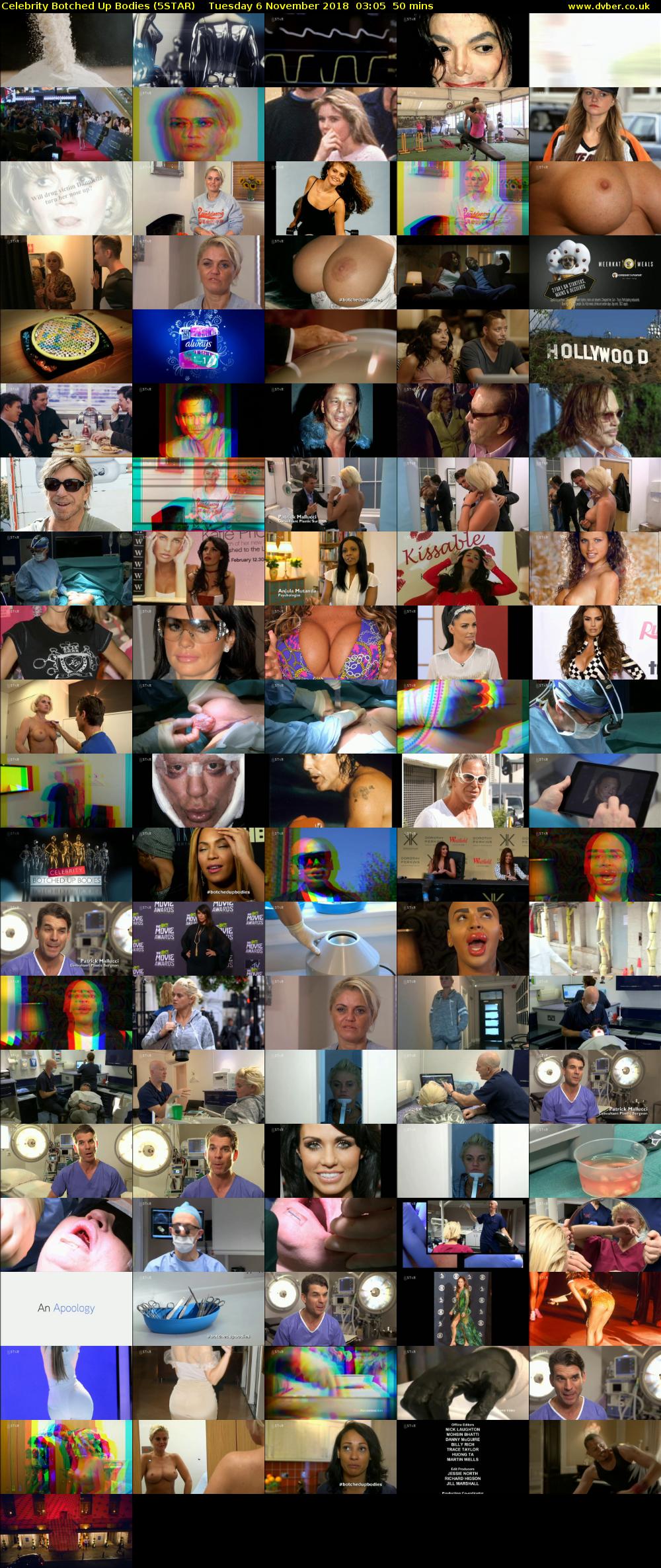 Celebrity Botched Up Bodies (5STAR) Tuesday 6 November 2018 03:05 - 03:55