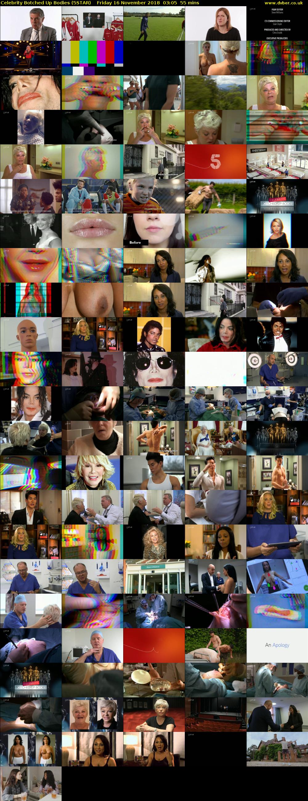 Celebrity Botched Up Bodies (5STAR) Friday 16 November 2018 03:05 - 04:00