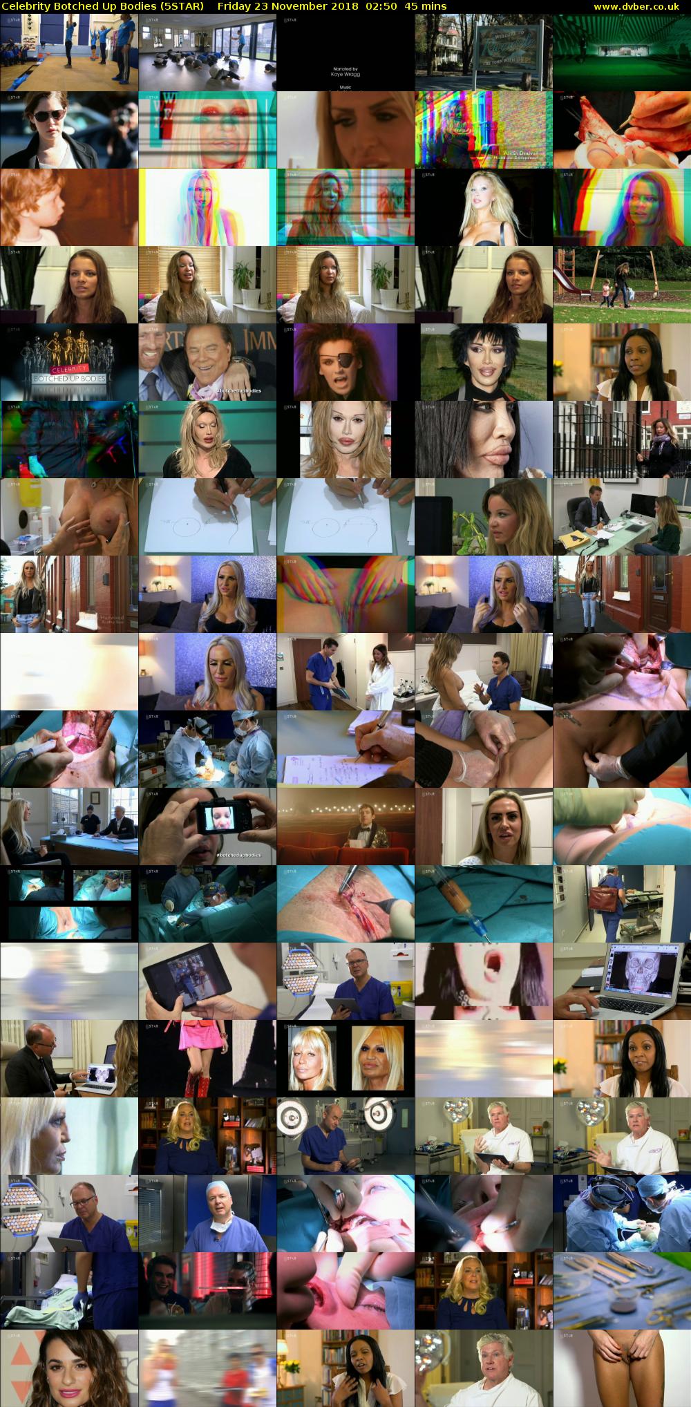 Celebrity Botched Up Bodies (5STAR) Friday 23 November 2018 02:50 - 03:35