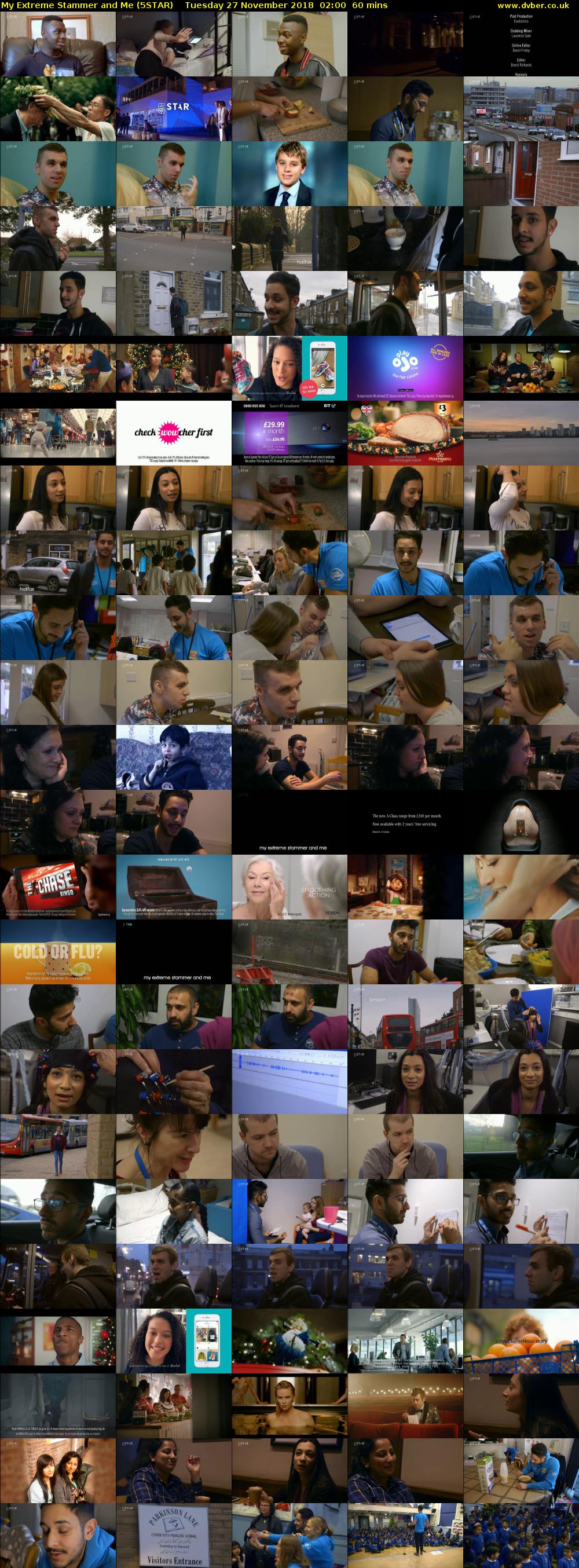 My Extreme Stammer and Me (5STAR) Tuesday 27 November 2018 02:00 - 03:00