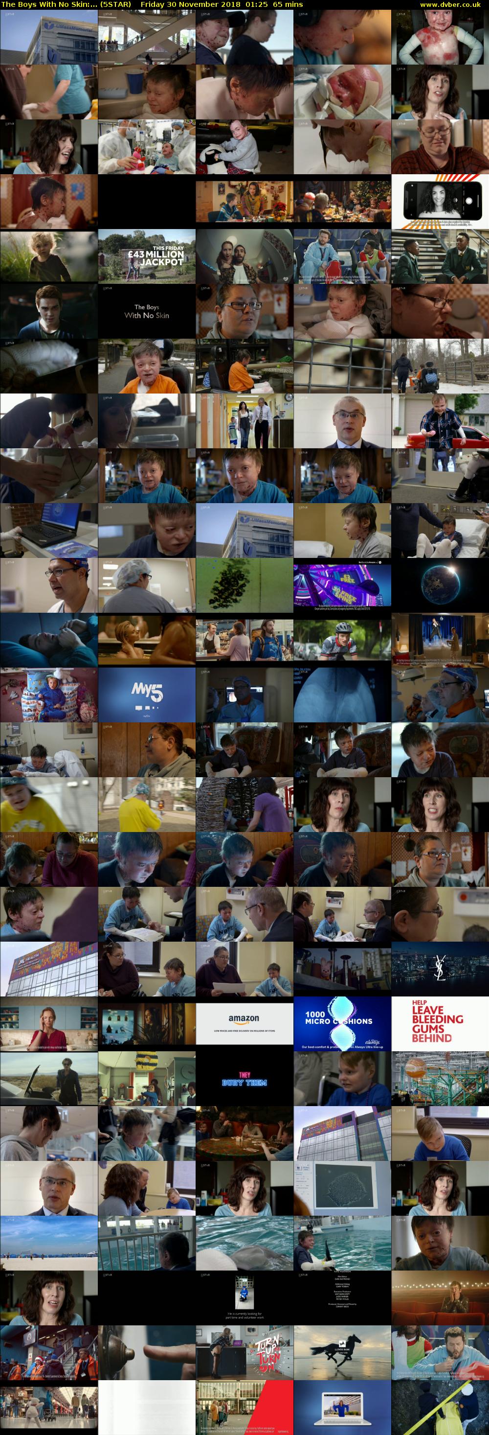 The Boys With No Skin:... (5STAR) Friday 30 November 2018 01:25 - 02:30